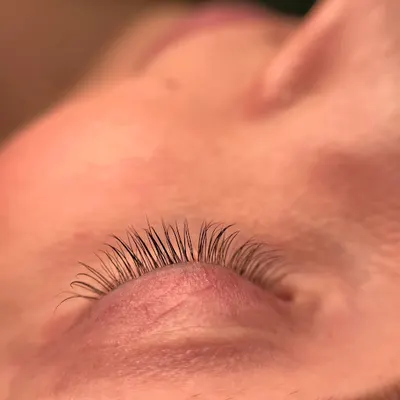 Med&Beauty Clinic - Salon Kosmetyczny Bielsko | Medycyna Estetyczna